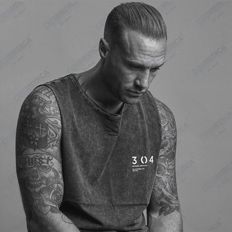 Calum Best after the operation at the Cosmedica Clinic