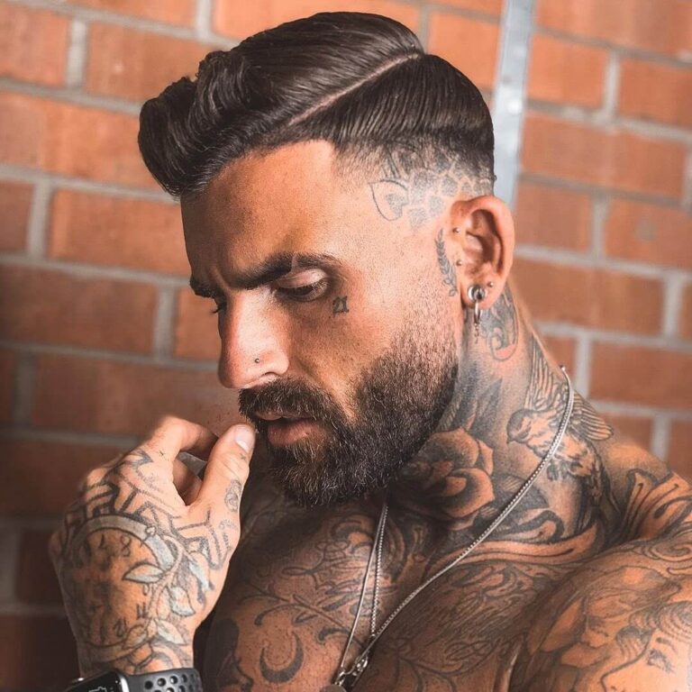 Chris Perceval after his hair transplant at the Cosmedica Clinic