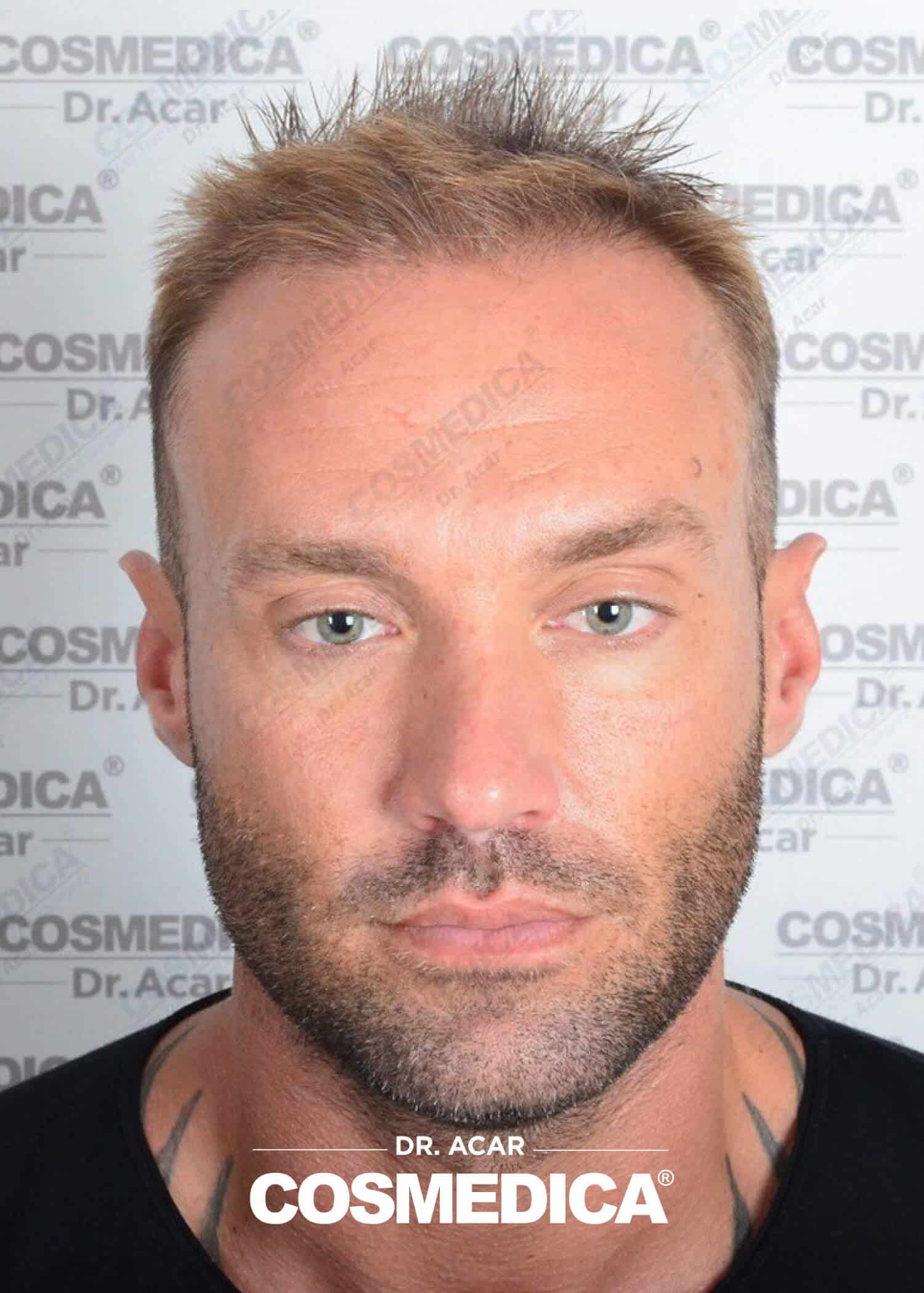 calumbest-celeb2.jpg
